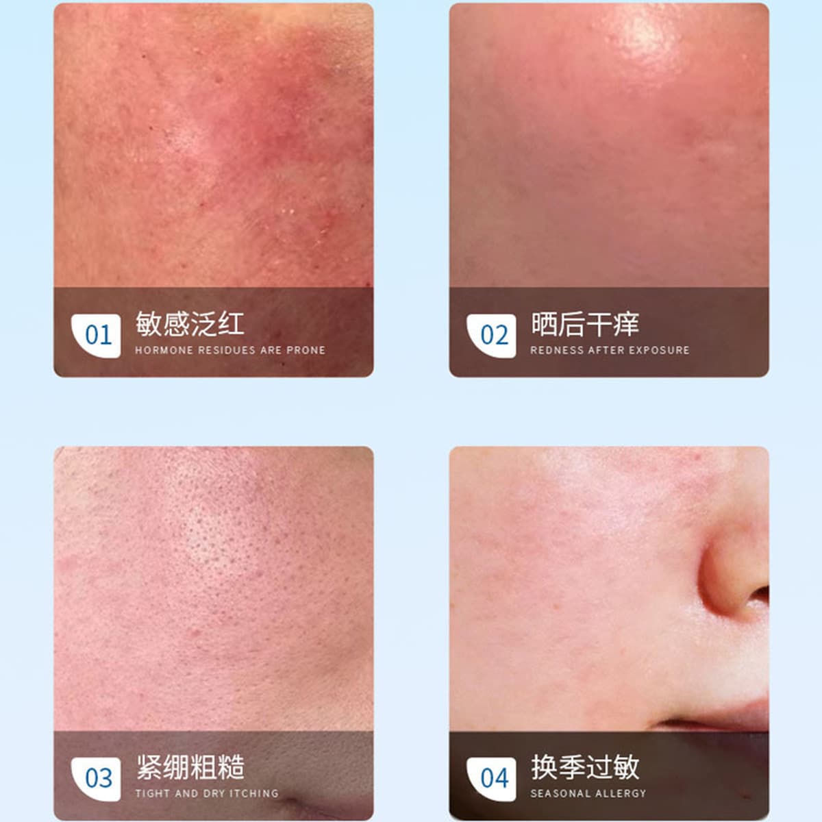 Набор специальных средств для ухода за кожей в салонах красоты: восстанавливает барьер, успокаивает чувствительность,...