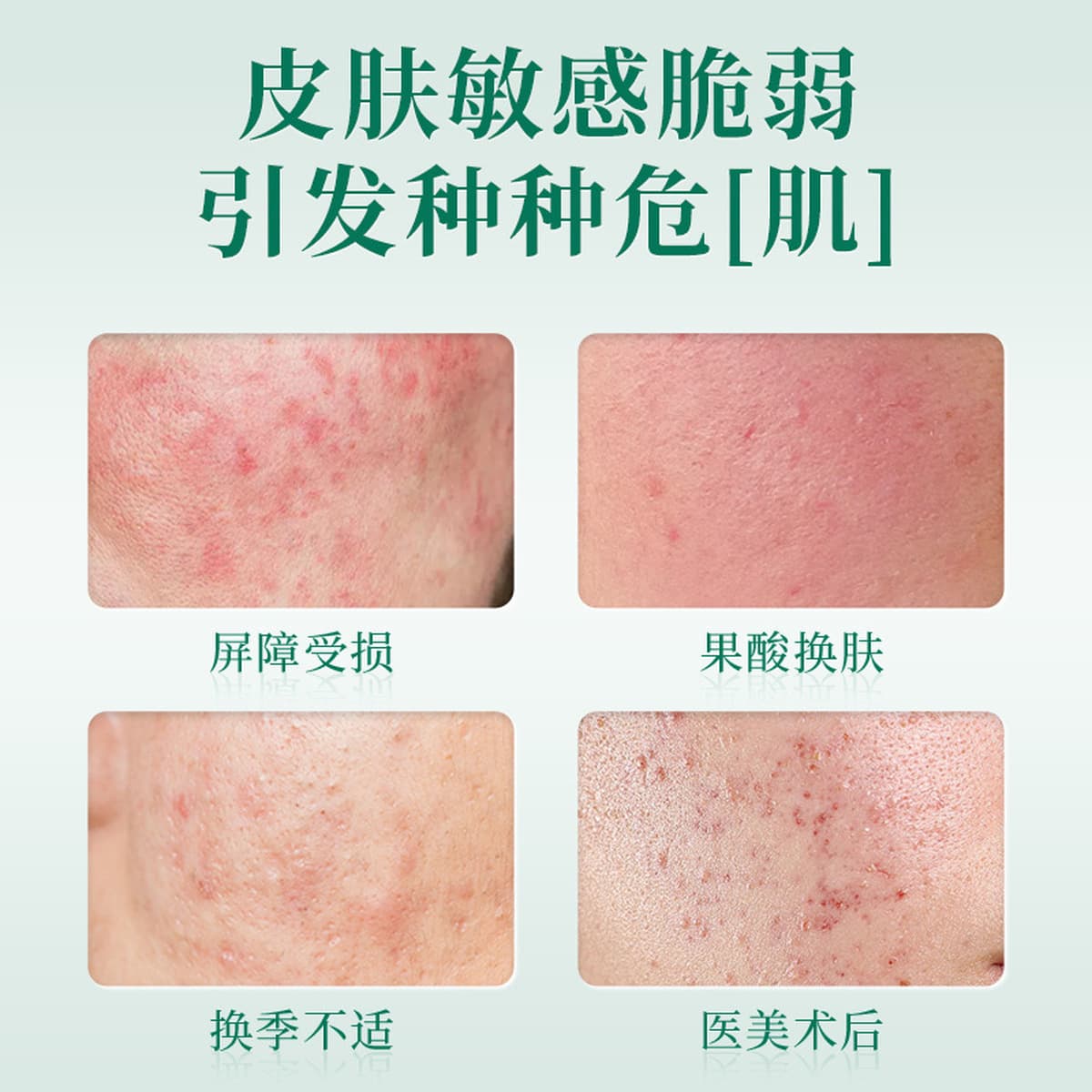 Toaneng Фармацевтическая медицина Гиалуронат натрия Уход за кожей крем 50 мл